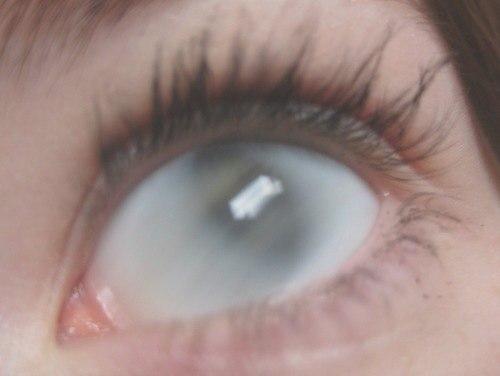 Фото Сдох Воскрес